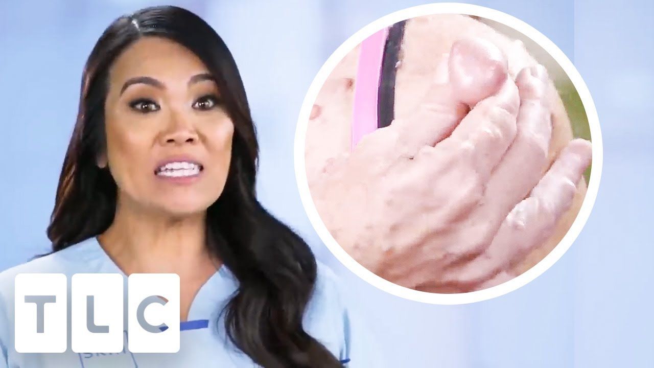 Mysterious Rashes, Cysts & More - Video Spotter