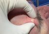 Extraction Whiteheads